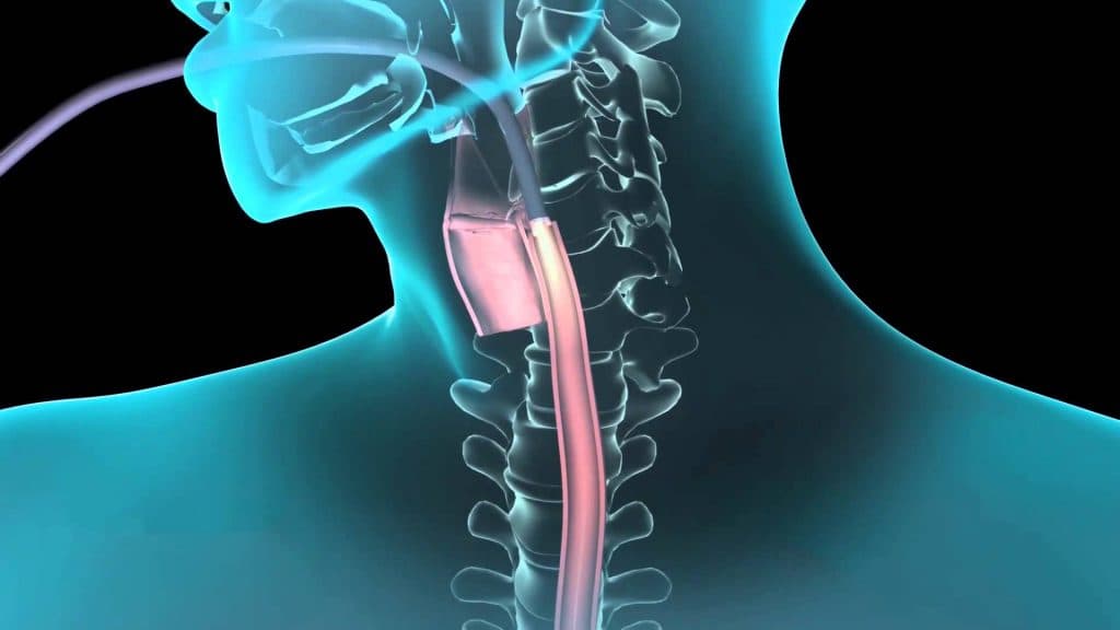 Endoscopy Market Trends & Developments